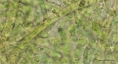 Una de las particularidades de las cianobacterias es que son un filo bacteriano caracterizado por tener clorofila y realizar la fotosíntesis.